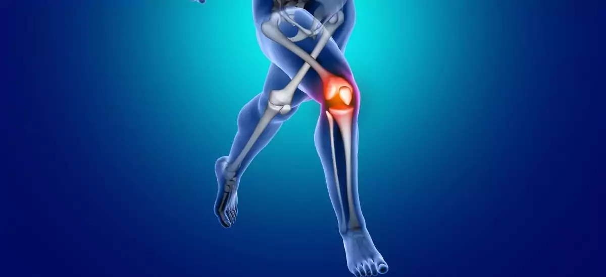 treatment for arthritis in knees