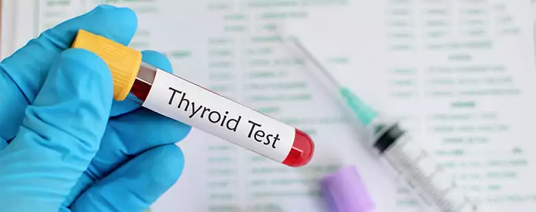hyroid blood test fasting