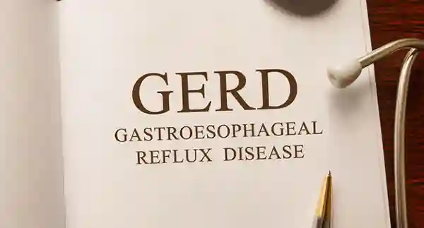 Facts About Acid Reflux