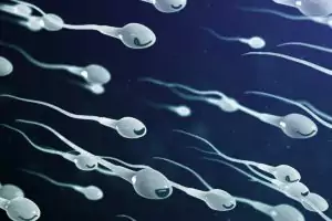 Sperm morphology (shape, size, and struct